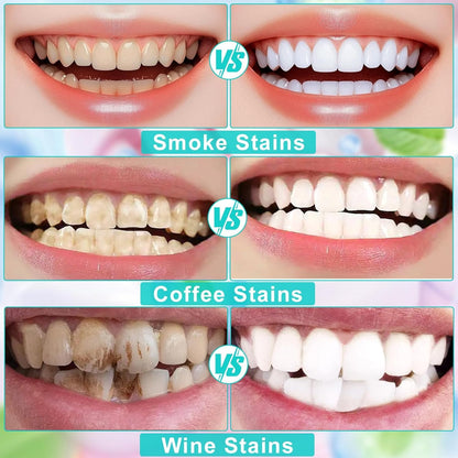 Niacinamide Whitening Toothpaste